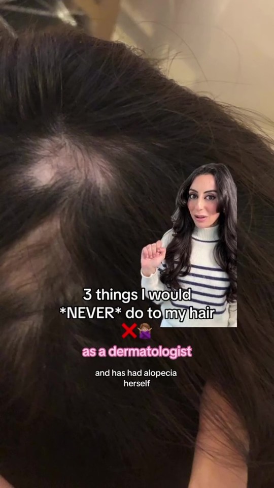 Dr Aamna used to suffer from hair loss