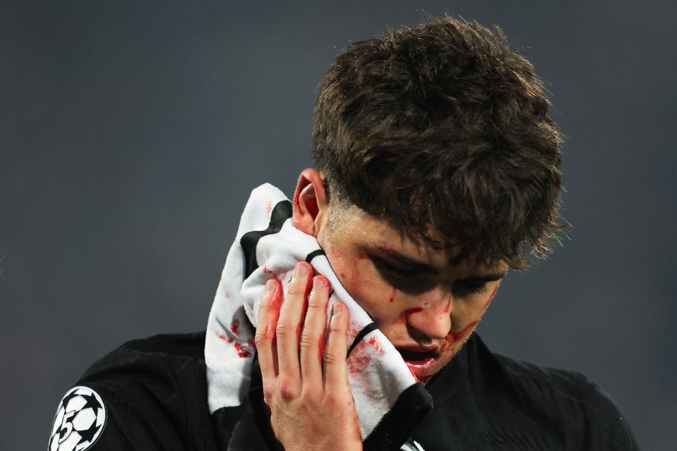 The wonderkid was covered in blood as he left the field