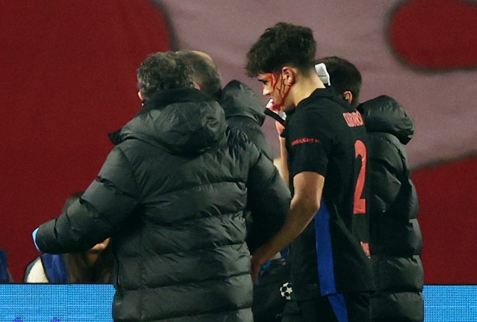 Blood poured down the side of his face as he was subbed off