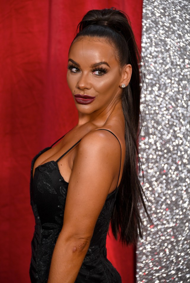 Chelsee Healey won't be dancing with Sylvian Longchambon