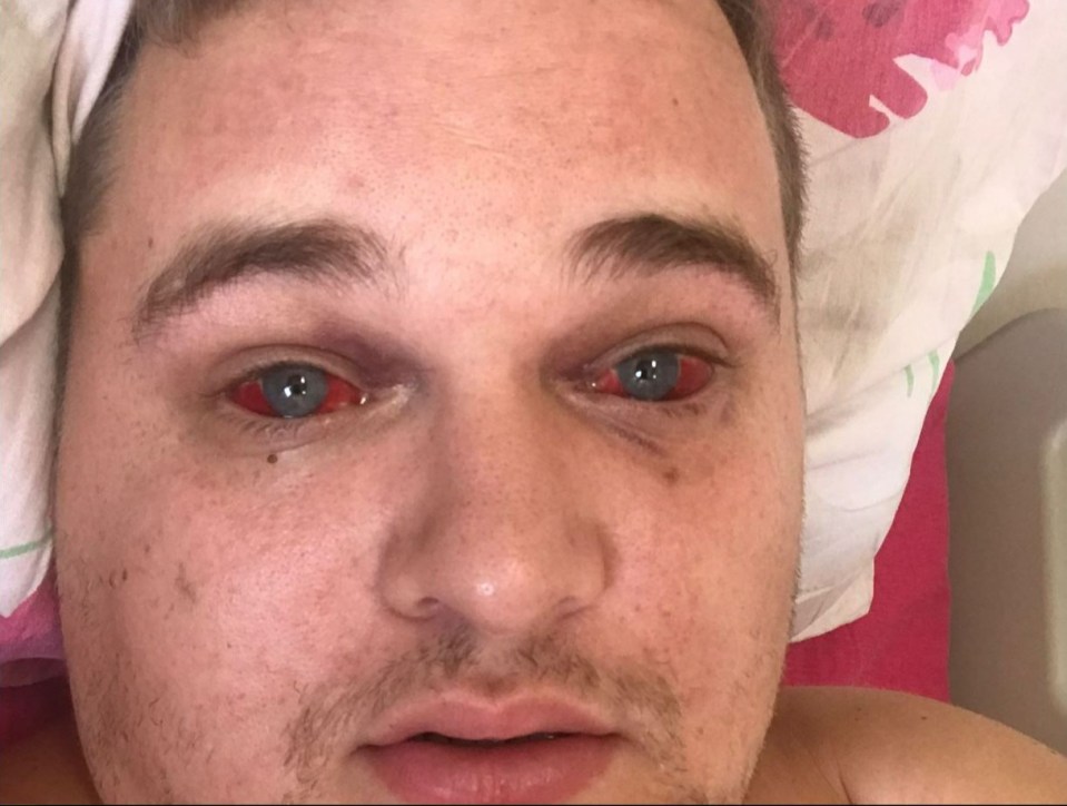 Leeds says he was 'left for dead' after the fall and starved for 10 days