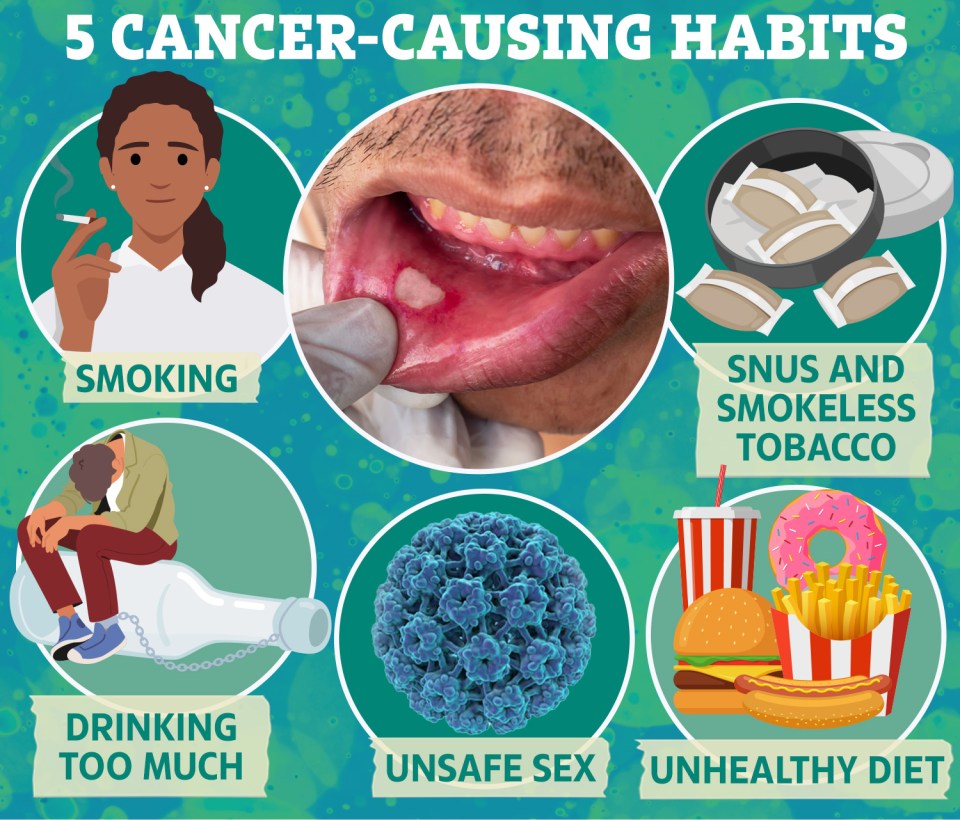 From drinking to diet, different habits that could increase your risk of oral cancer