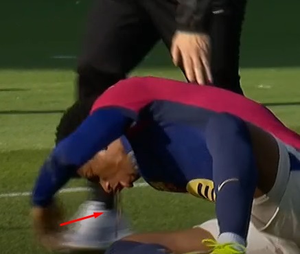 The left-back appeared to be coughing up blood on the pitch