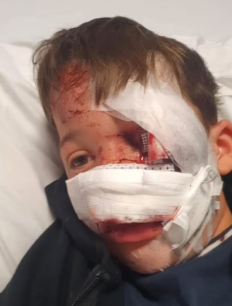 Carter Ralph's mother shared the shocking extent of his injuries