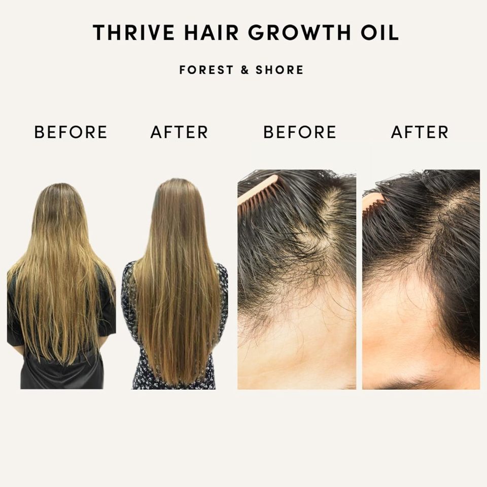 The oil claims to 'speed up hair growth'