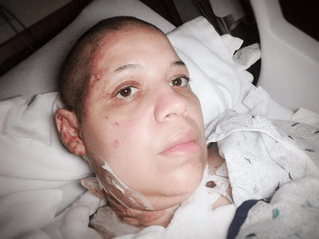 a woman with a shaved head is laying in a hospital bed