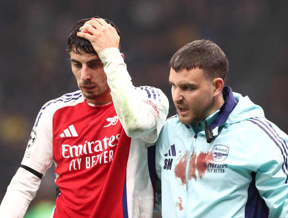 Kai Havertz is a doubt for Arsenal's trip to Stamford Bridge after requiring stitches after a clash of heads