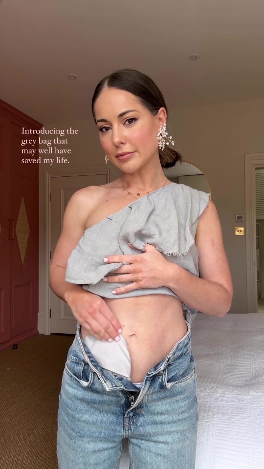 Louise Thompson had a stoma bag fitted in January