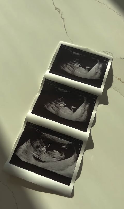 They shared her ultrasound scans in a video posted to Instagram