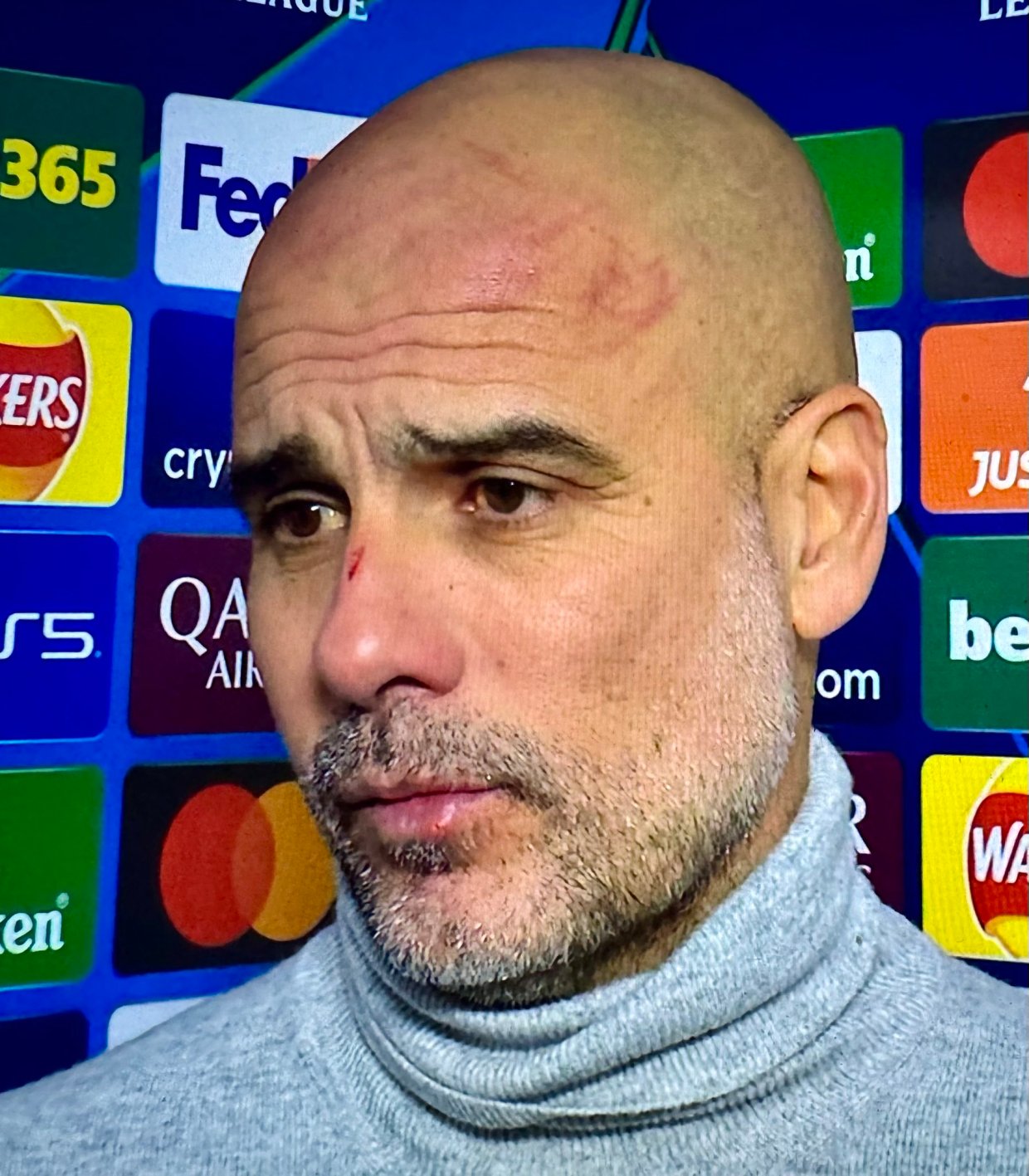 Guardiola said 'I want to harm myself' when questioned about the scratches