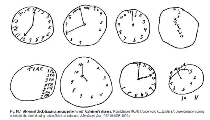 a black and white drawing of clocks with time written on them