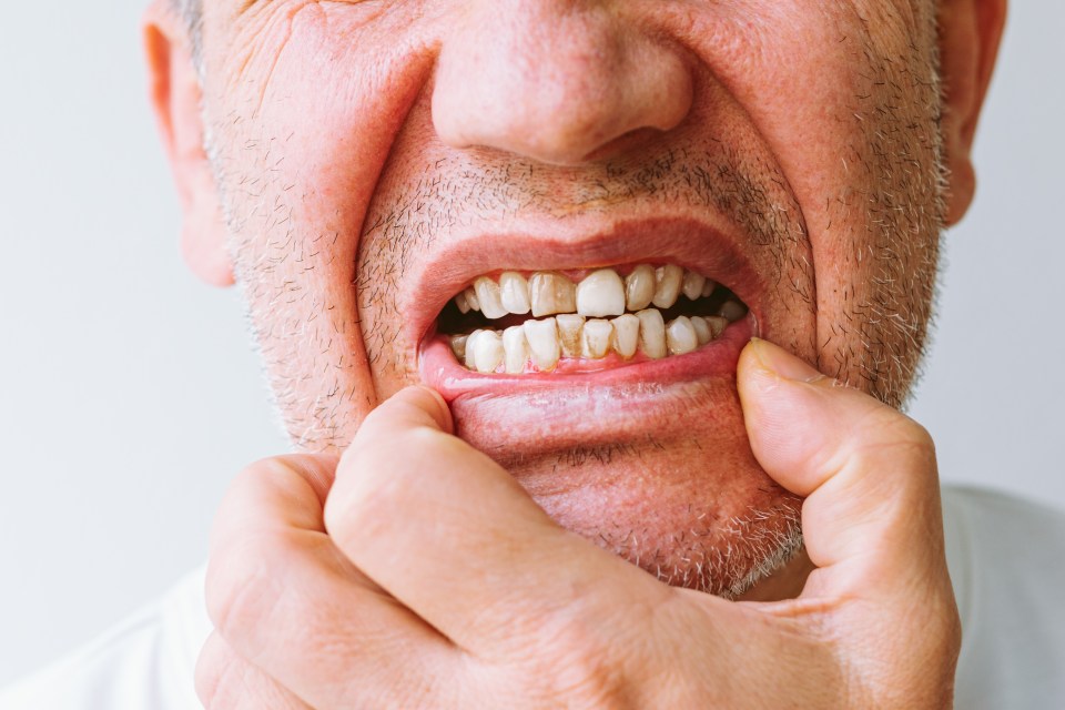 Your teeth change a lot as you age and you can expect certain issues at every decade