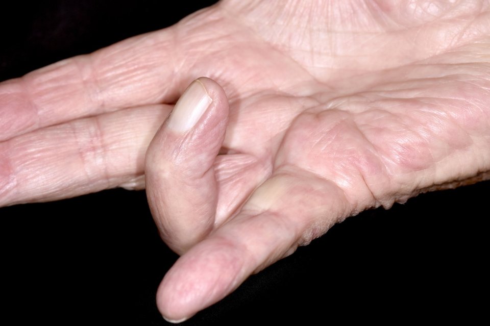 a close up of an older woman 's hand with a black background