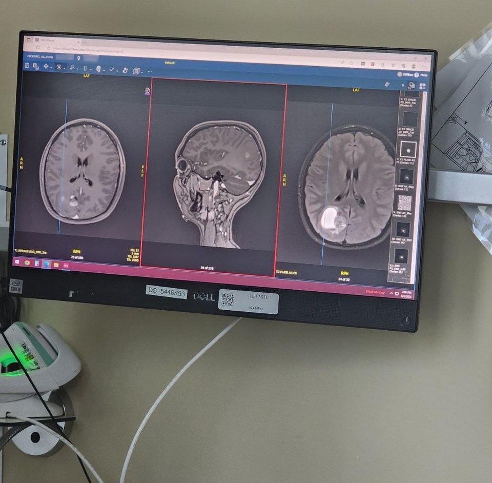 a dell monitor shows a picture of a brain