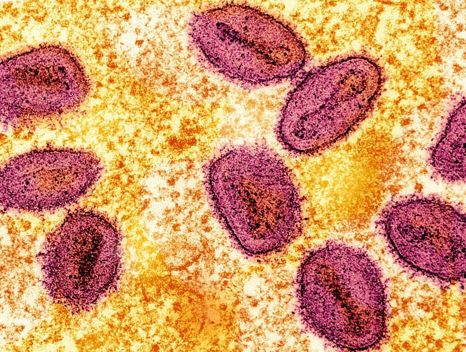 A fourth case of a new strain of mpox has been detected in the UK