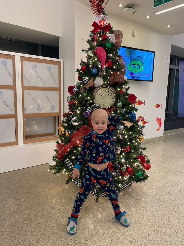 A young boy with no hair stands in front of a Christmas tree.