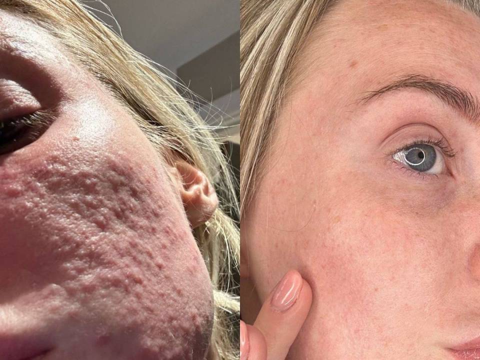 47Skin fans have been sharing their skincare journey since using the products