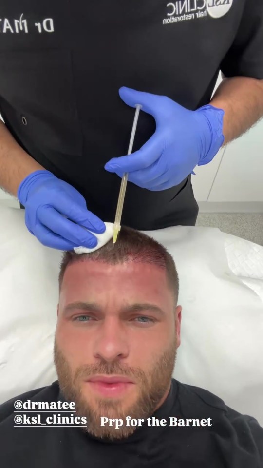 Man receiving PRP injections in his scalp for hair loss treatment.