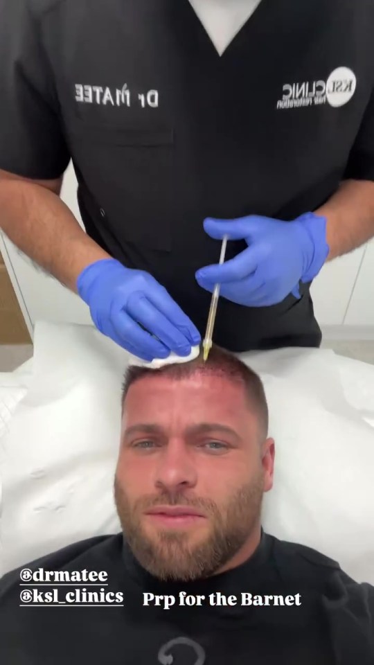 Man receiving PRP injections in his scalp for hair loss treatment.