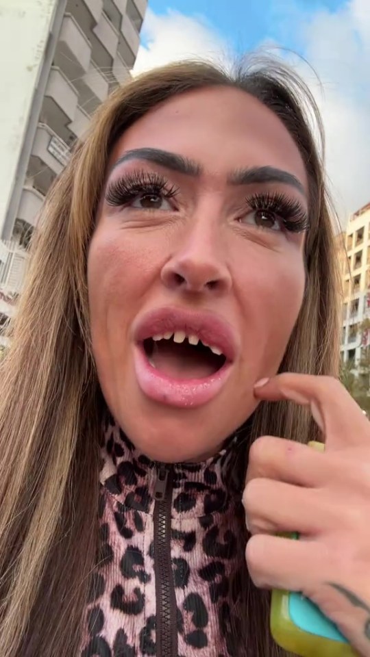 Woman's new veneers fell out.