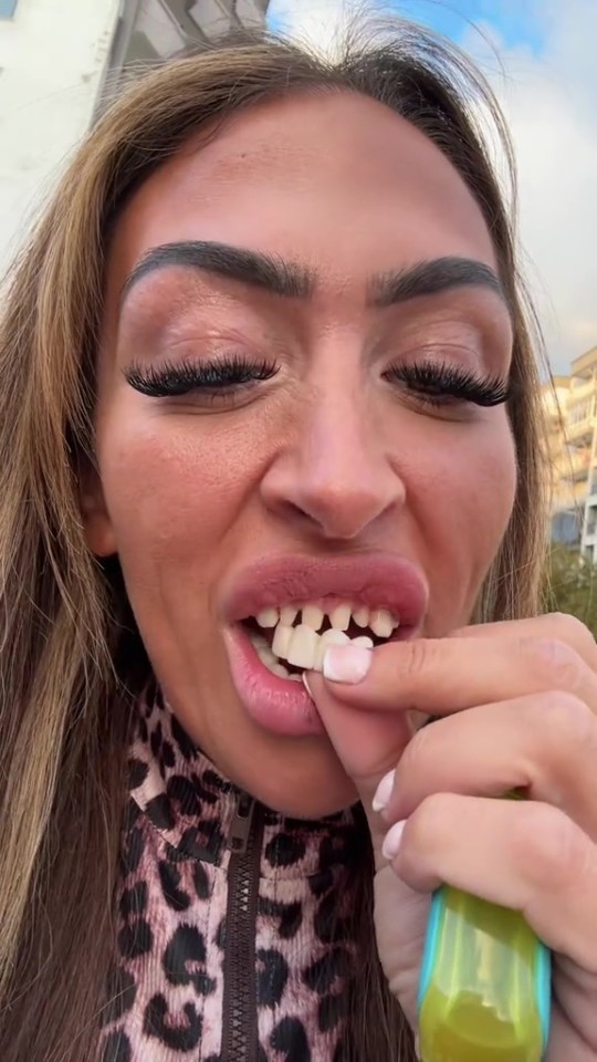 Woman holding a fallen veneer from her £4,650 new teeth.