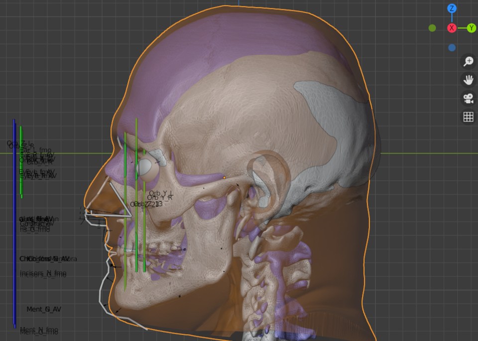 Experts forensically rebuilt his features using his skull