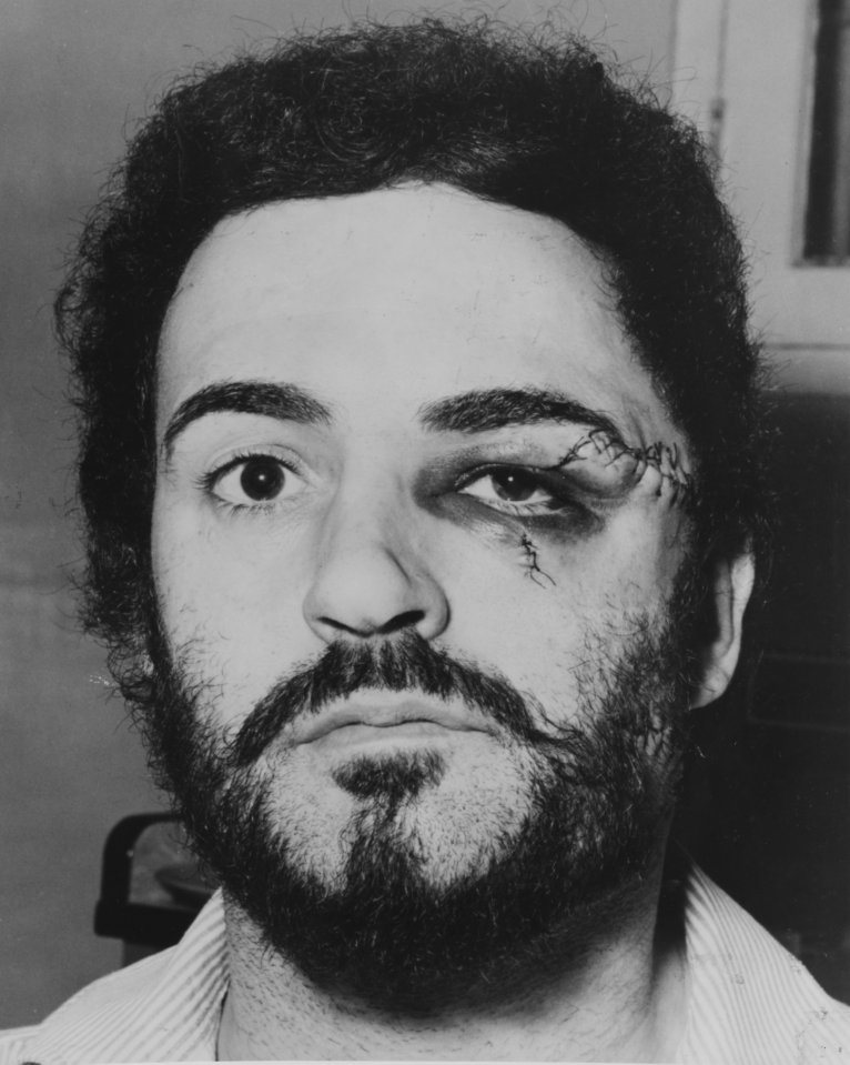 The Yorkshire Ripper after being brutalised with a coffee jar