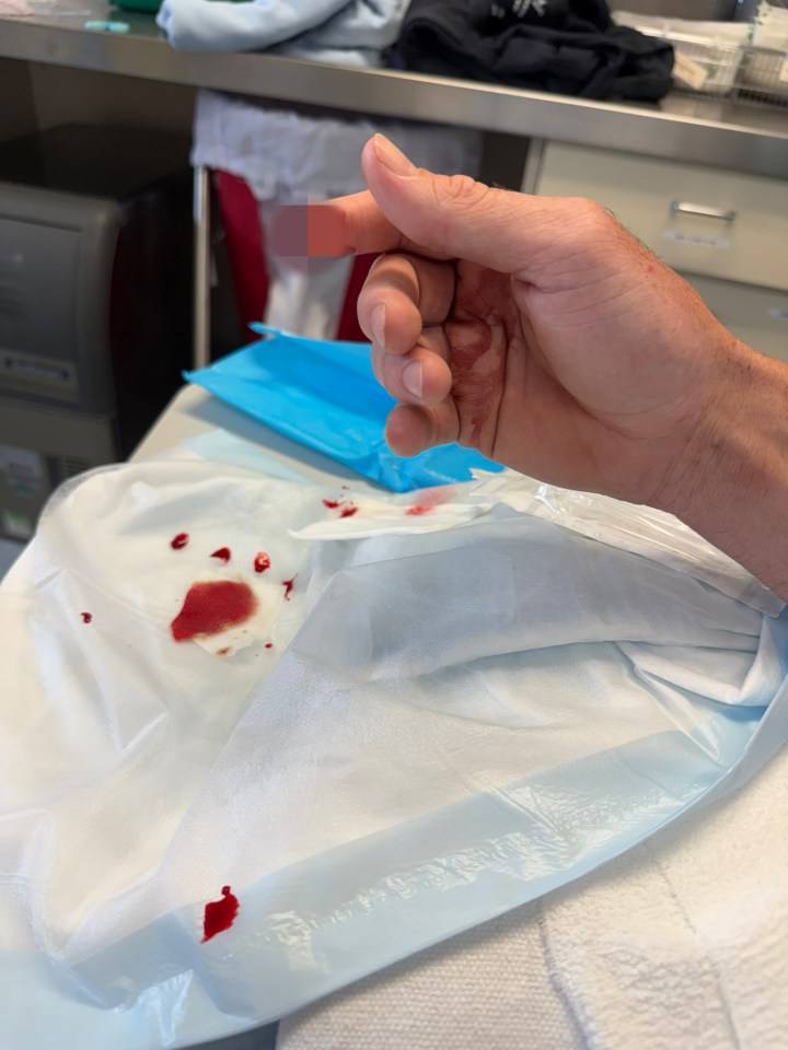 The tip of jockey James Orman's finger was bitten off by angry racehorse Prince Of Boom