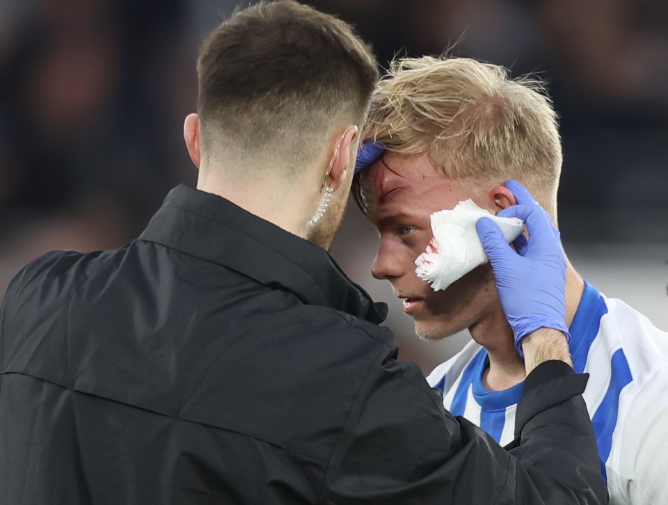 The accidental collision left the Dutchman needing treatment from the Brighton medical staff