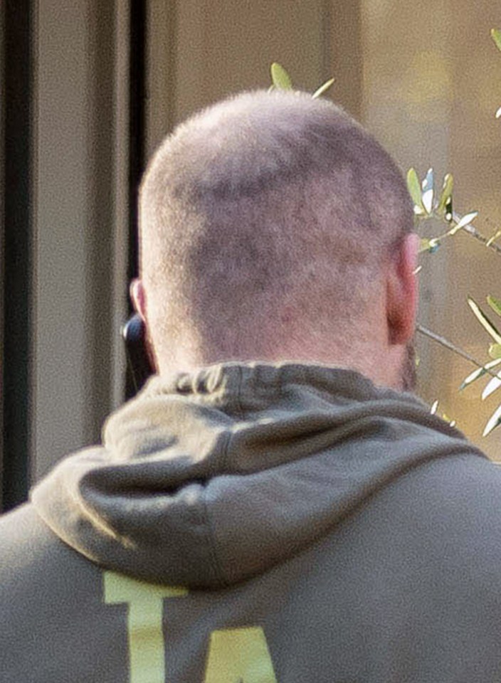 The hair regrowth was already visible just weeks after his 'preventative measure'