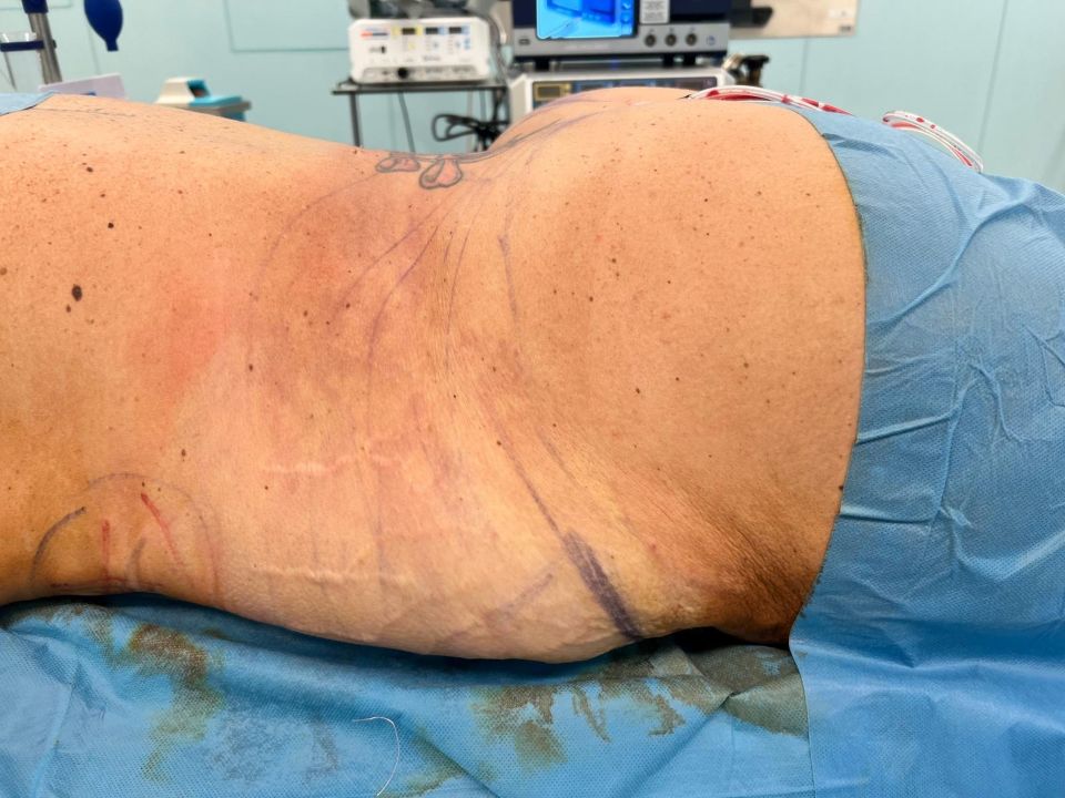 The mum underwent three botched surgeries