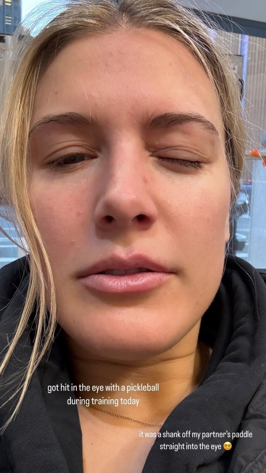 Eugenie Bouchard suffered a freak eye injury during a pickleball training session