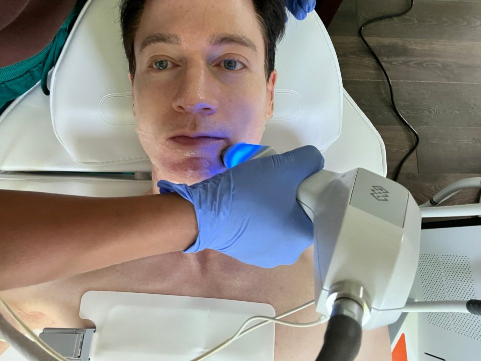 Exilis Ultra 360 skin tightening treatment on a man's face, neck, and hands.