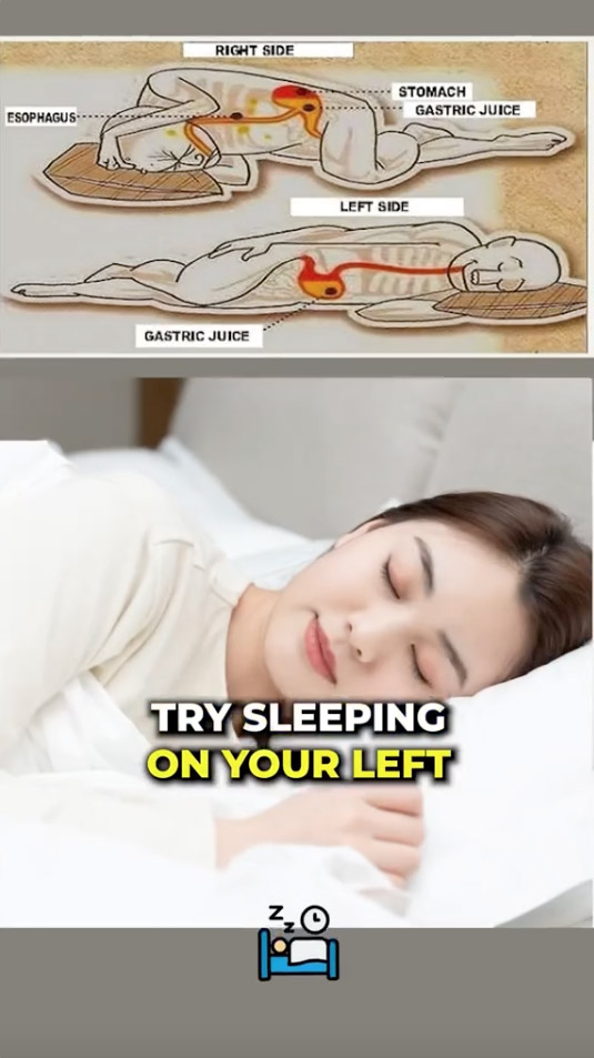 For occasional heartburn try sleeping on the left side of your body