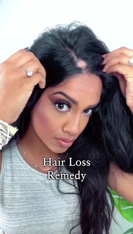 Woman demonstrating a hair loss remedy.