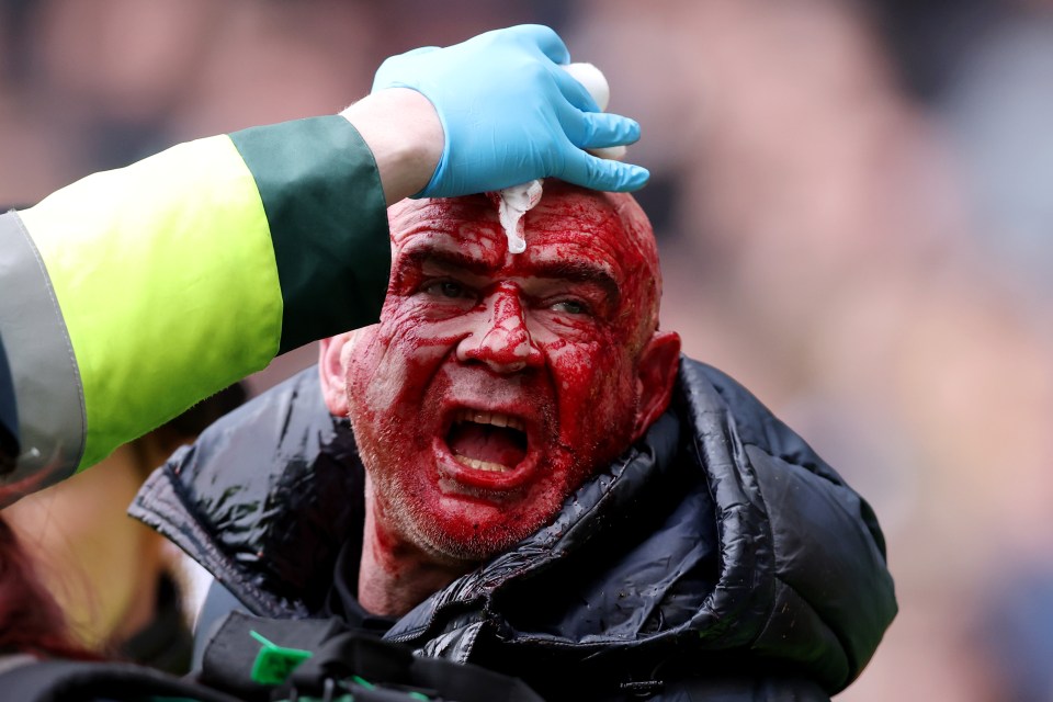 A bloodied supporter being escorted away by  police during the FA Cup clash between West Brom and Wolves, January 2024