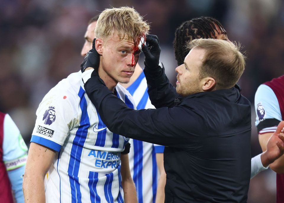 Paul van Hecke was left with blood pouring down his face during Brighton v West Ham