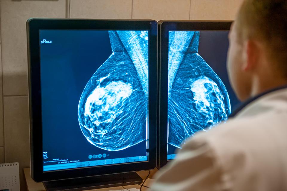 Women are invited for regular breast cancer screening after the age of 50 (stock image)