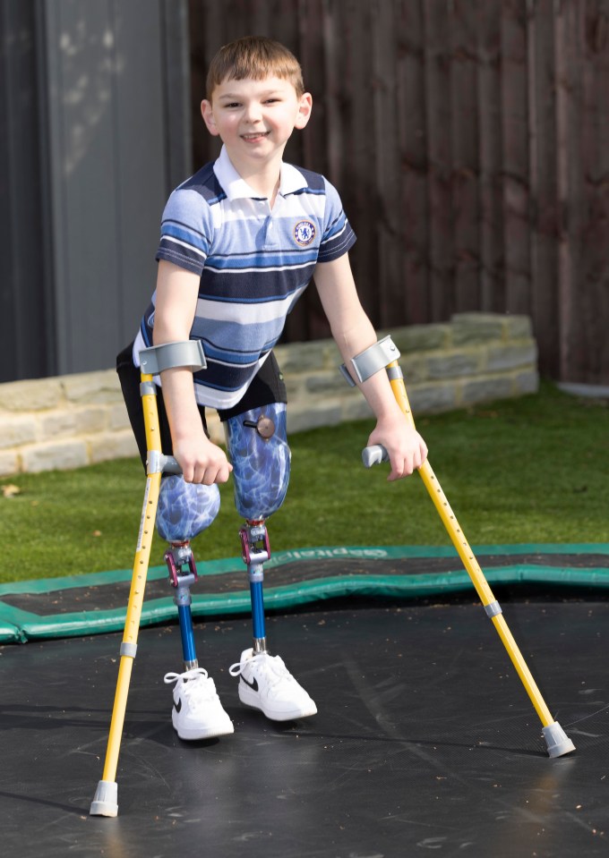 Tony Hudgell has had surgery to help him walk unaided