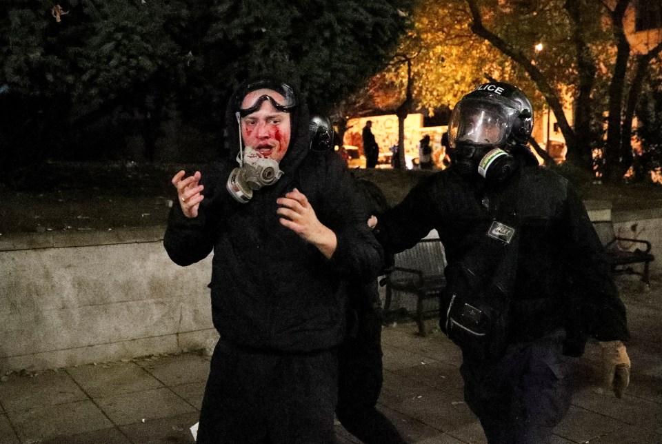 Police officers escort a demonstrator with a bloody face during the brutal clashes