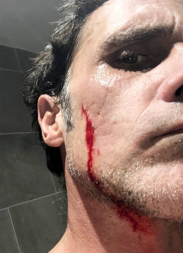 Nick Silverthorn cut himself shaving with a supermarket own brand razor