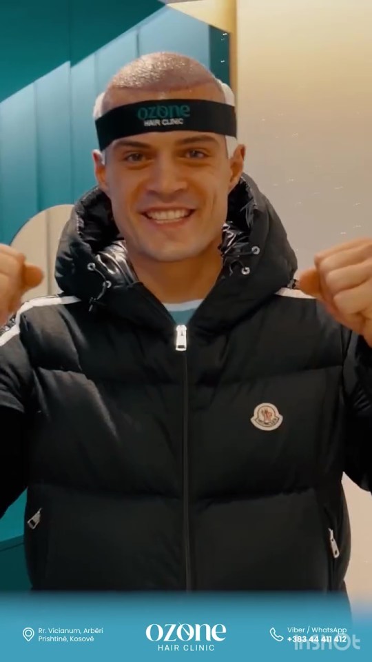 Granit Xhaka at Ozone Hair Clinic after a hair transplant.