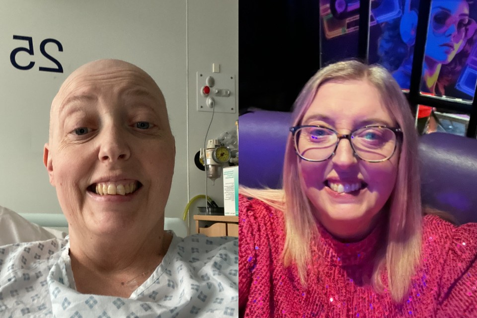 Before and after photos of a woman with multiple myeloma.