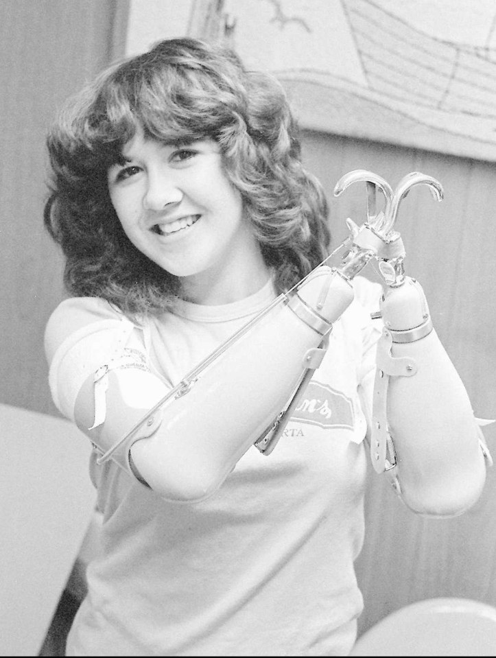 Black and white photo of Mary Vincent with prosthetic arms.