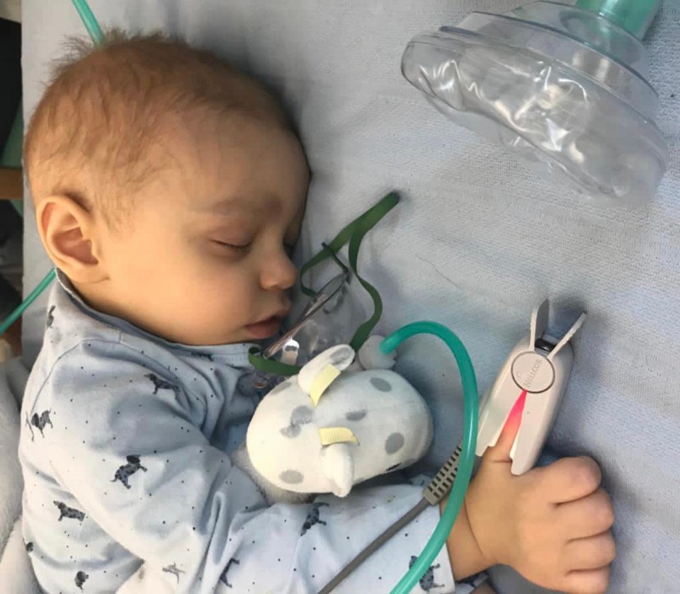 A toddler sleeps in a hospital bed with medical equipment attached to his thumb.