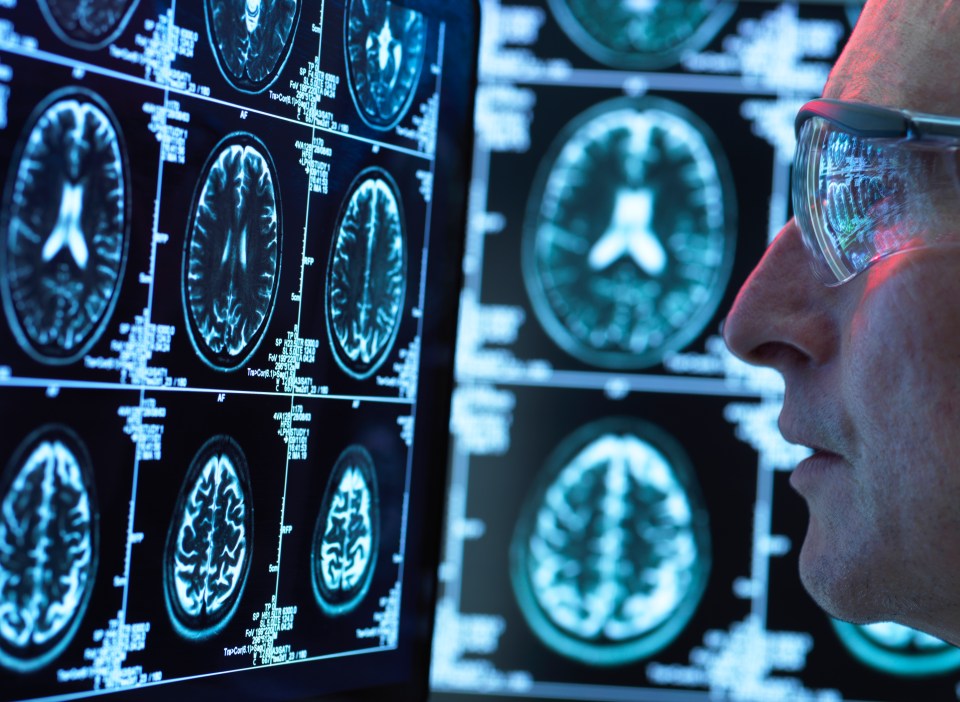 A scientist examines brain scans on a computer screen.