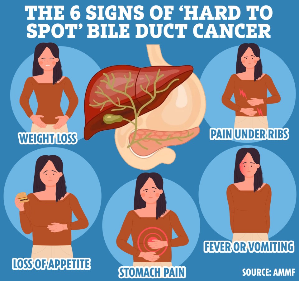 Illustration of six symptoms of bile duct cancer: weight loss, pain under ribs, fever or vomiting, loss of appetite, stomach pain.