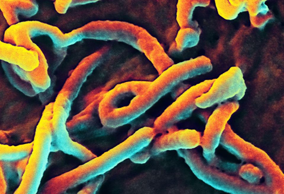 Scanning electron micrograph of Ebola virus budding from a Vero cell.