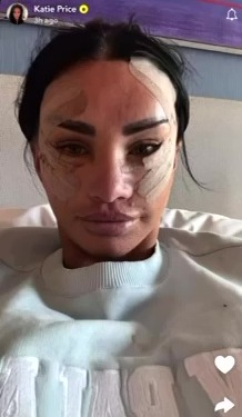 Katie Price selfie showing her face with bandages after facial surgery.