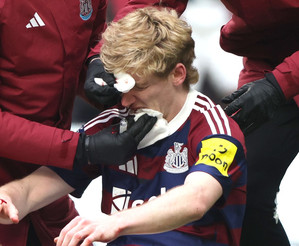 Anthony Gordon with a bloody nose during a Tottenham Hotspur v Newcastle United match.